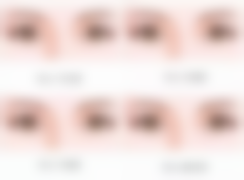 手术切除：应对重度增生的手段