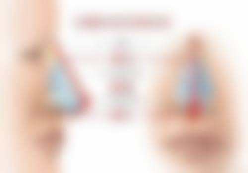 刚割完双眼皮能睡觉吗？能！充足睡眠助恢复，垫高枕头可消肿，术后护理别马虎！ 