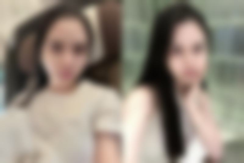 刚割完双眼皮睡觉，注意事项不能少