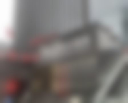 重庆松山医院医学美容科做鼻子 术后一度嫌太高很焦虑，2个月恢复超自然，段主任真靠谱