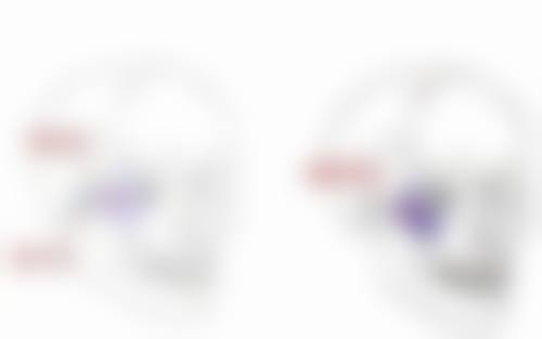 用什么办法可以除皱？动态纹打肉毒素（维持4 - 6个月），静态纹选玻尿酸填充（维持6 - 12个月）！ 