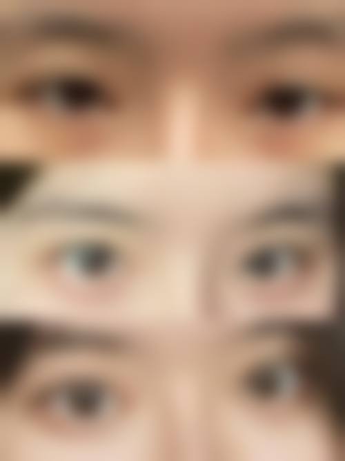 凯里维纳斯整形美容诊所特色项目及技术优势