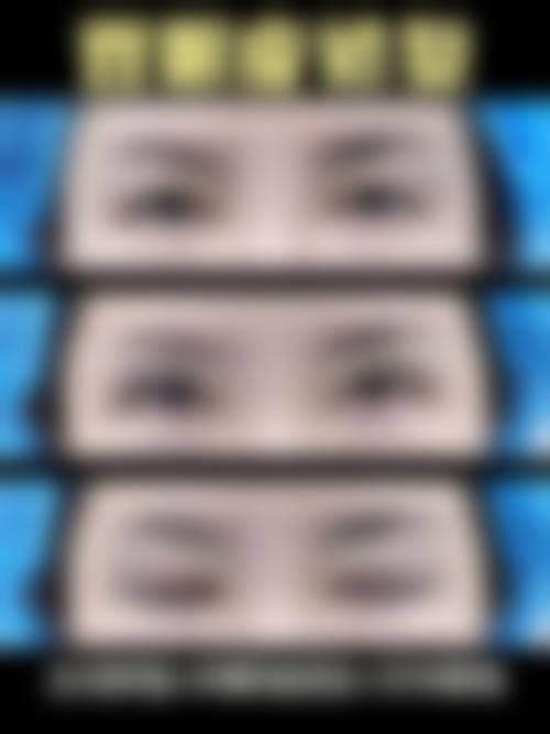 凯里维纳斯整形美容诊所真人口碑评价怎么样?