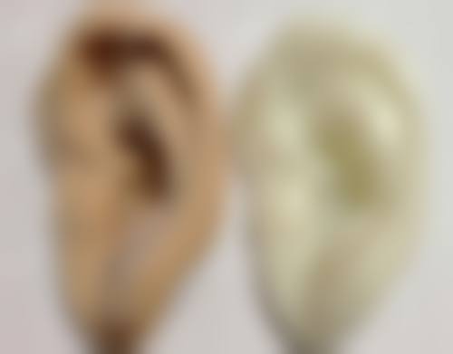 张晓彤医生：矫正修复口碑良好