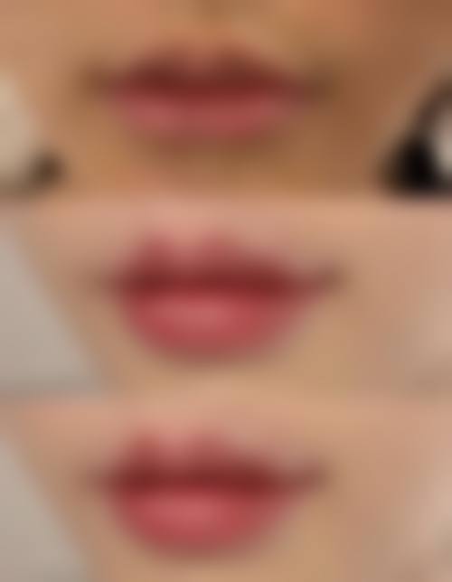 广州雍华慧妮美容特色项目及技术优势