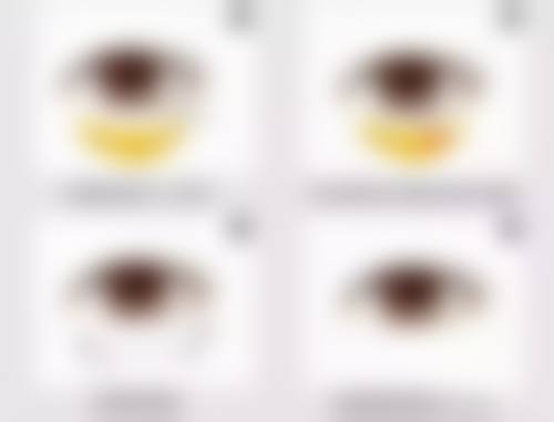 艾灸治疗疤痕增生的实际实例分享