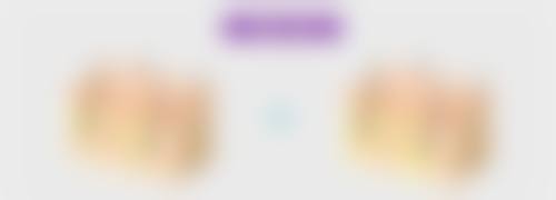 手术切除除病根，重度眼袋不再愁