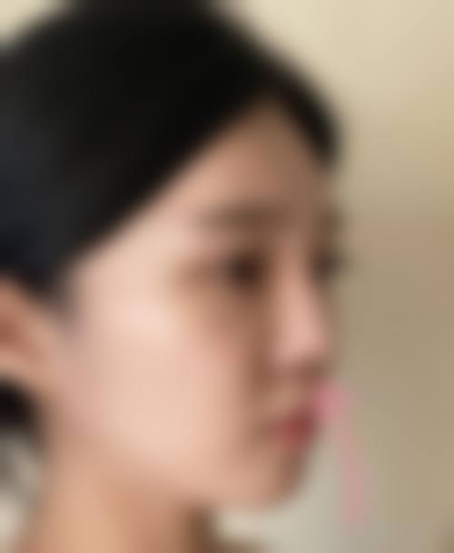 上海佳富美美容门诊部真人口碑评价怎么样？