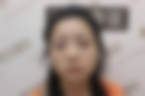 熊靖民医生技术优势