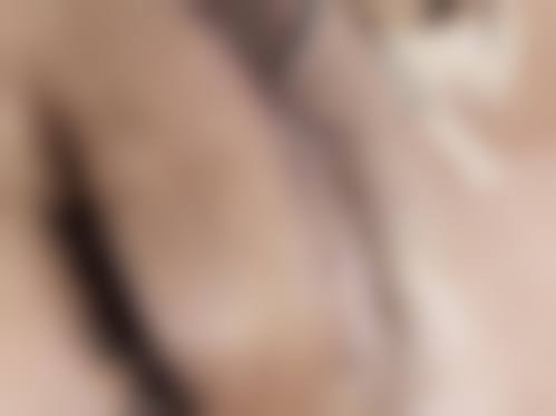 熊靖民医生擅长项目