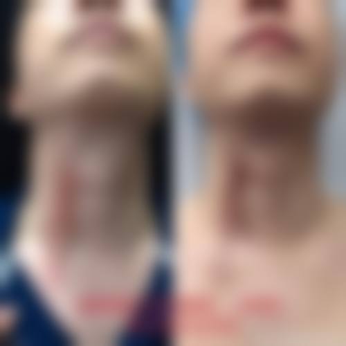 张琴真医生预约挂号