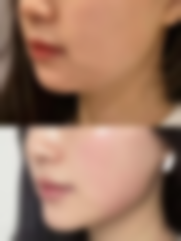 医美机构大比拼，优质选择解烦忧