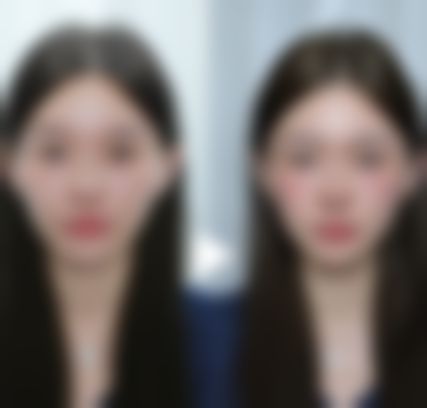 疤痕增生能用艾灸吗？能！艾灸可活血化瘀促循环淡化疤痕，但要结合医院专业修复方案（如激光、手术治疗） 