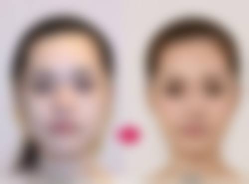 适当休息，创造良好修复环境