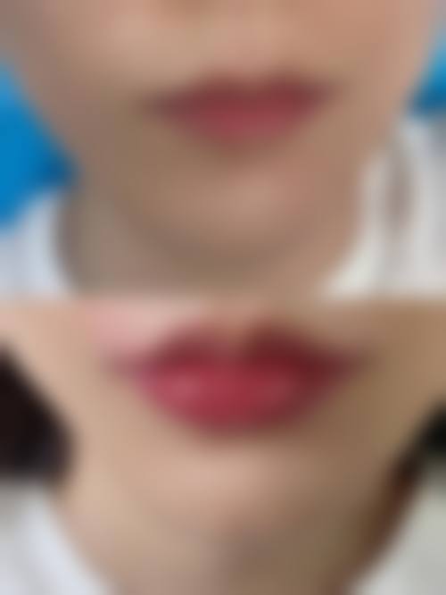 天津华津皮肤病医院整形美容科特色项目及技术优势