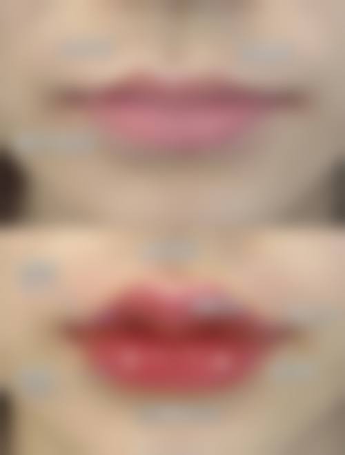 荆门玫漫医疗美容门诊部详细的预约挂号方式及流程