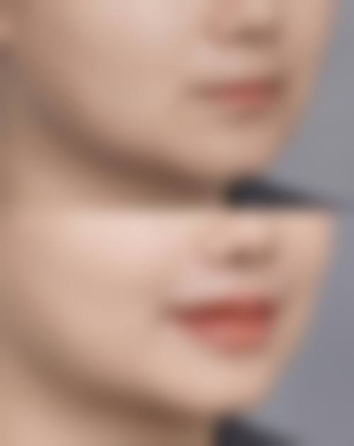 荆门玫漫医疗美容门诊部真人口碑评价怎么样？