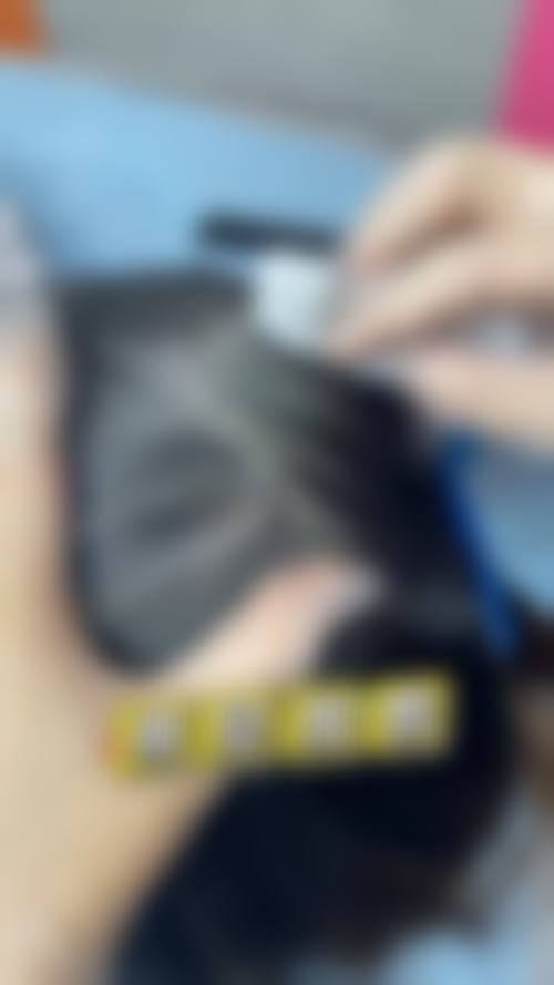 北京毛发移植医院排名前五，北医三院、八大处、中德领衔，技术优、口碑好、成效佳！ 