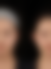 手术风格与理念