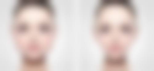 割双眼皮多久能健身？埋线双眼皮7 - 10天可低强度运动，全切则需14 - 30天！ 