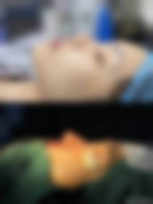 上海娜慕医美是正规的医院，卫健委认证资质透明，张瑞红医生技术好，口碑超赞！ 