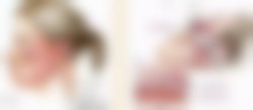 如何去除皱纹和眼袋？试试眼部筋膜提升、张姣姣联合术，效果看得见！ 