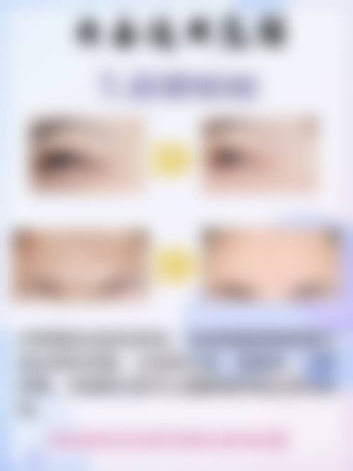 做完双眼皮一个月哭了会影响效果吗？一般不会，此时创口已愈合，短哭影响小，后续注意护理就行！ 