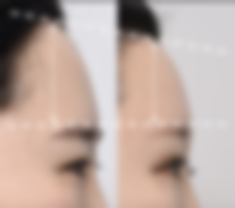 宁德整形医院十大排行榜：宁德华美等上榜，隆鼻1980元起，口碑获患者认可！ 