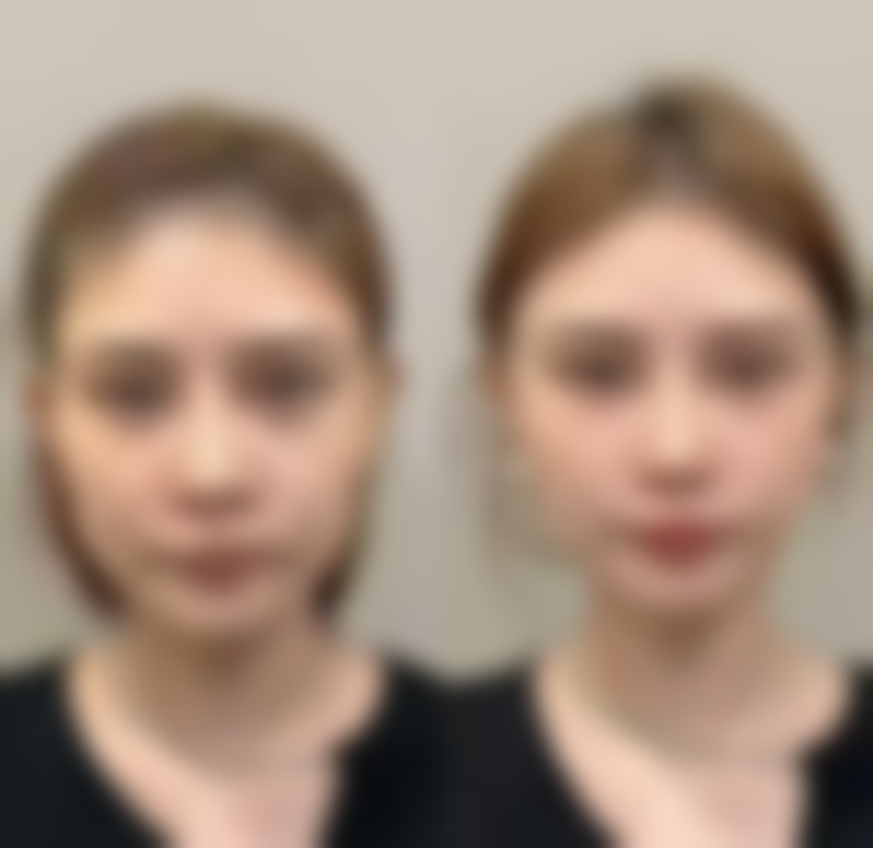 宁德蕉城东方医院美容科