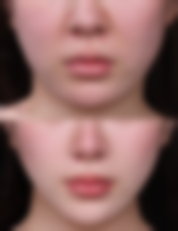 宁德霞浦县医院整形外科