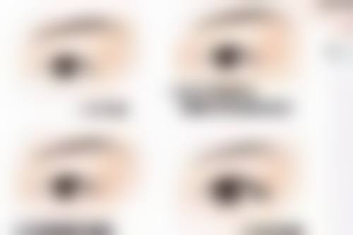 怎么能让单眼皮变双眼皮？可试试贴双眼皮贴，想永久变双，南昌颜咖、郑小红医生手术值得选！ 