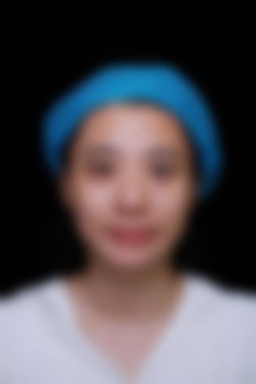 杭州张霞飞双眼皮做的怎么样？格莱美张霞飞技术佳，审美自然，双眼皮修复11000元起！ 