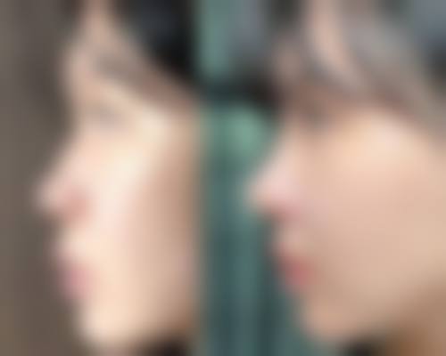 泸西鑫鑫整形医院详细的预约挂号方式及流程