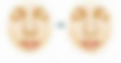 脱发类型及综合解决方案