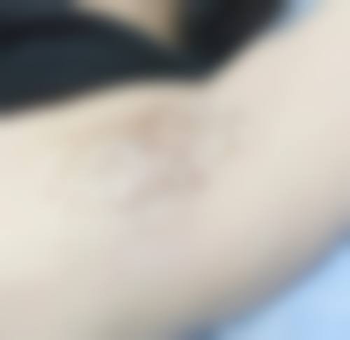 陈晓华医生技术优势