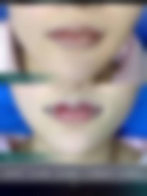 南京口腔医院医疗美容科地址电话营业时间