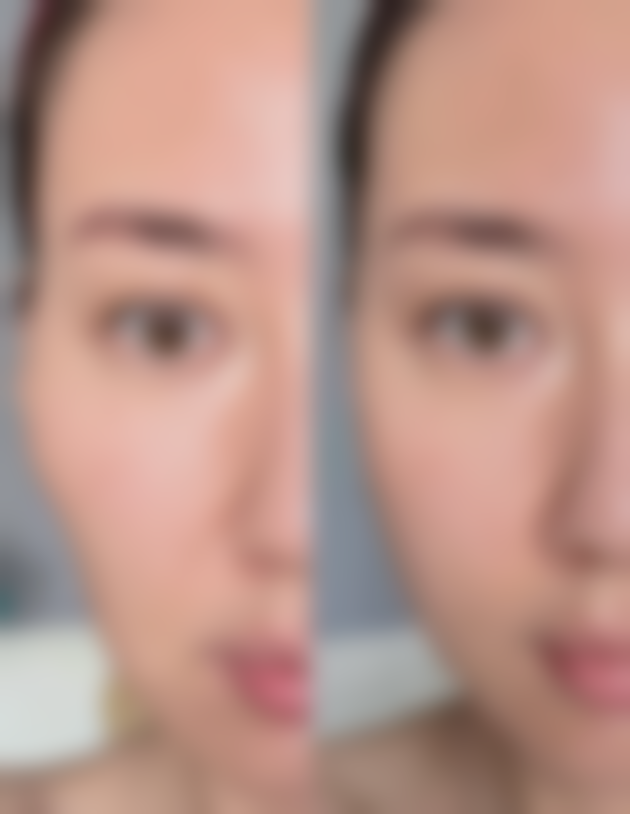 种头发原理头发种植的原理是什么？原来是将后枕部毛囊移植到脱发区，重庆华夏美姿植发效果自然恢复快！ 