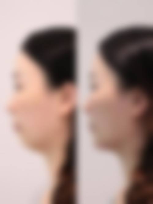 周口雅美天成医疗美容门诊地址电话营业时间