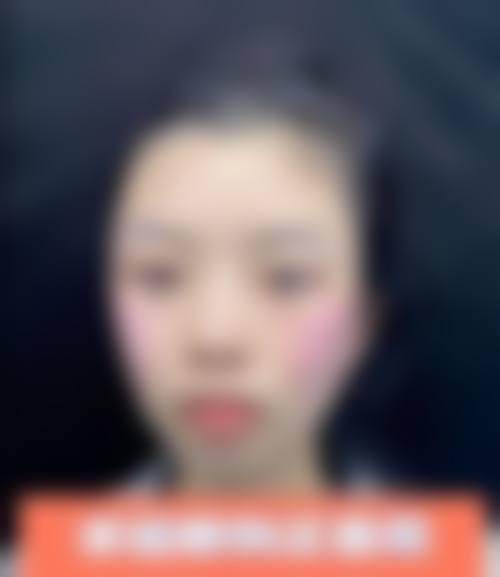 周口雅美天成医疗美容门诊真人口碑评价怎么样？