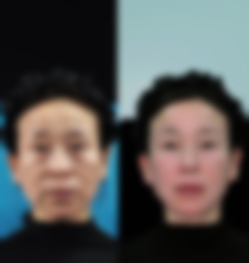 铜陵小氧未来嘉美整形医院特色项目及技术优势