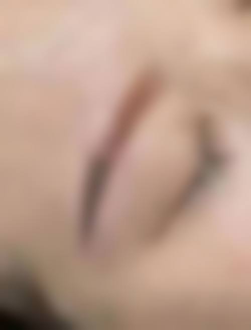 成都高新新瑞凯文医疗美容诊所特色项目及技术优势