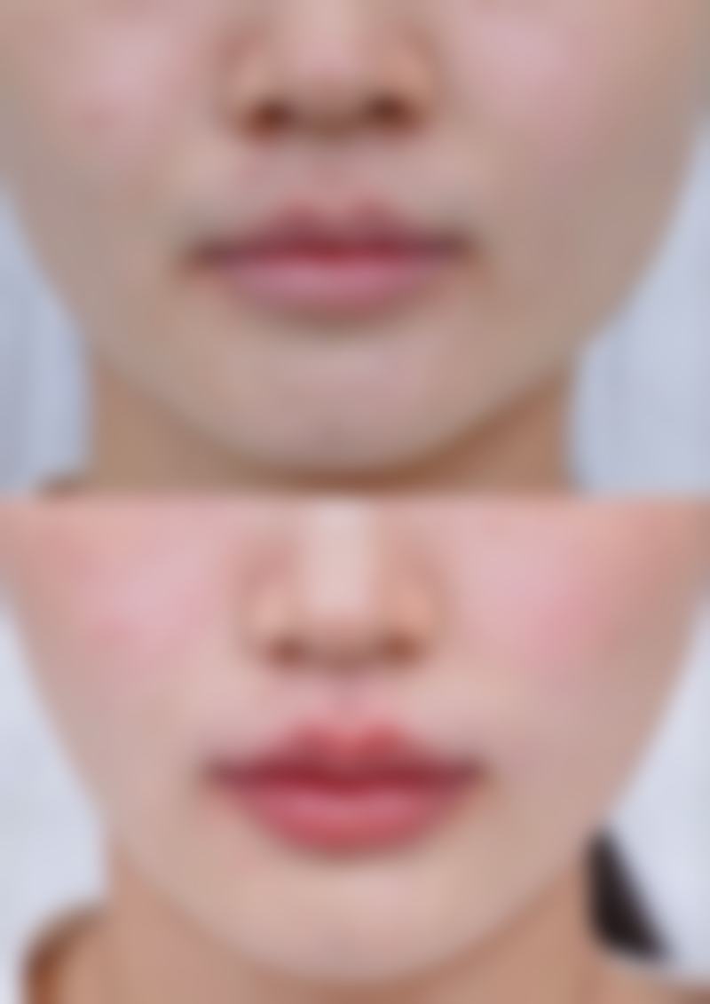 成都高新新瑞凯文医疗美容诊所收费价格表/收费标准