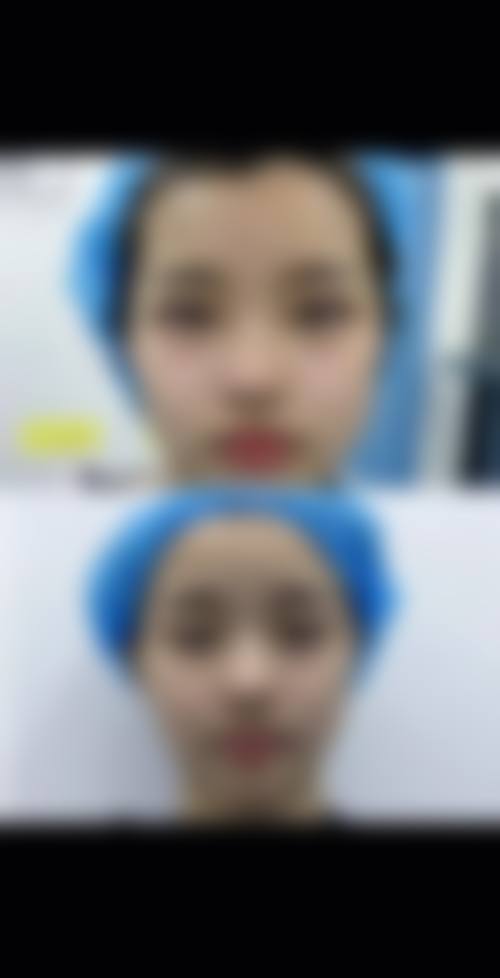 南京华美眼部整形优势