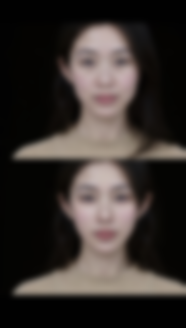 怎么可以臀部抽脂？选XX市第一人民医院或XX整形美容医院，技术优效果好还能预约！ 