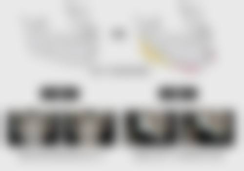 联合开眼角:放大眼睛的更佳选择