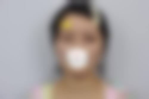 薛重科医生口碑评价及真人实例