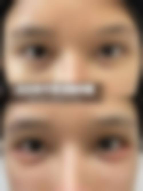 南宁熠美医疗美容诊所收费价格表/收费标准