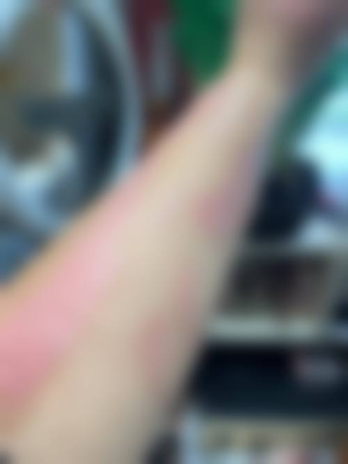 患者反馈口碑佳