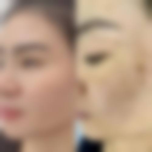 南充韩美整形特色