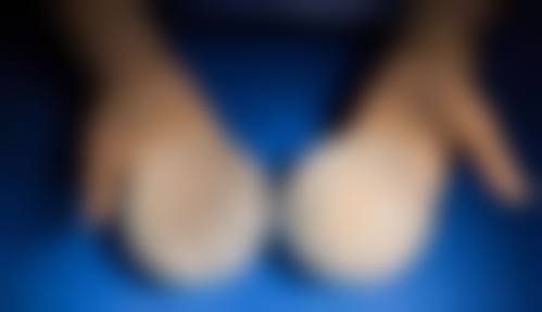 南阳市静欣医疗美容诊所真人口碑评价怎么样?